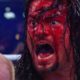 Roman Reigns Bleeds WrestleMania 34